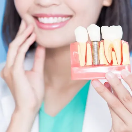 What is the Difference Between Dental Implants & Veneers