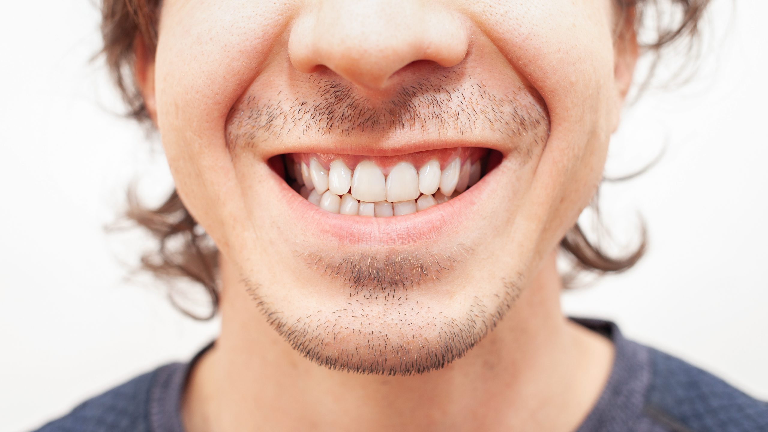 Close up portrait smile teeth man. white beautiful teeth after whitening, alignment isolated
