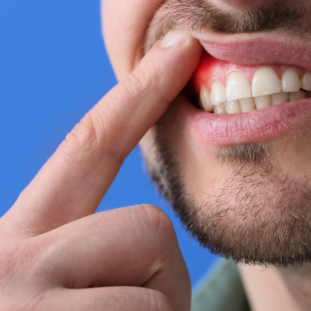 Periodontist Can Help with Serious Gum Disease