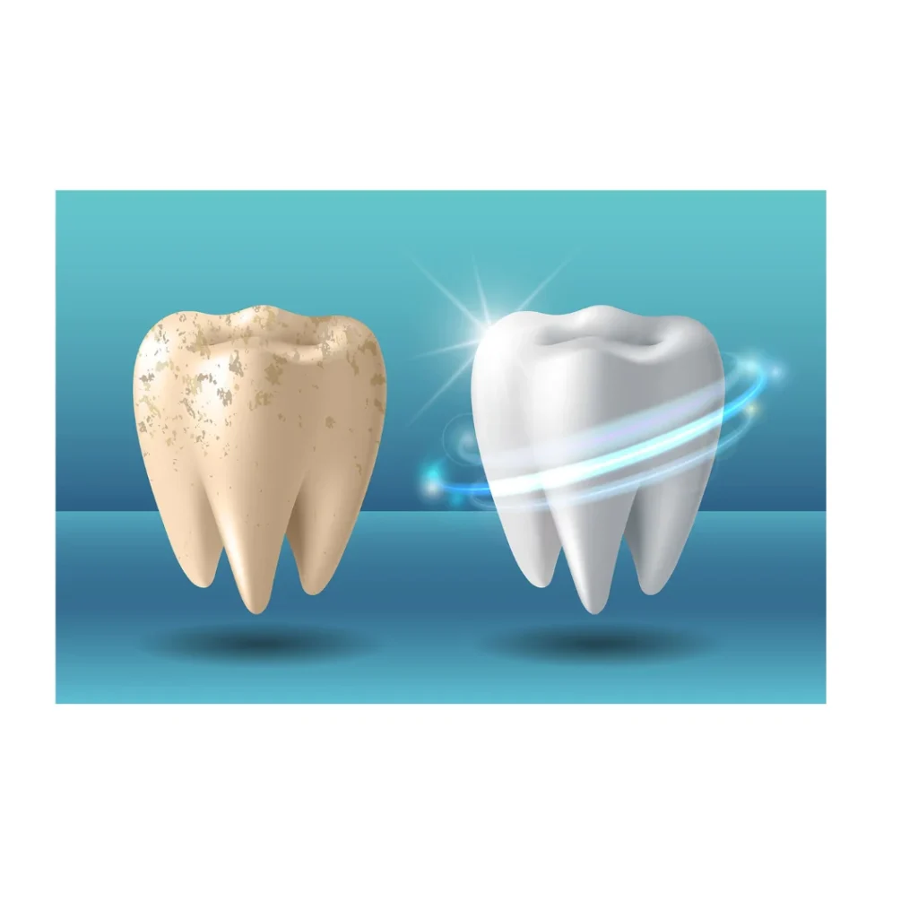 Are Wisdom Teeth Really Necessary to Remove?